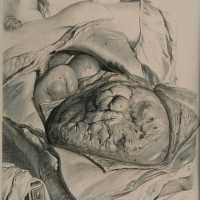 Bidloo surgical anatomy