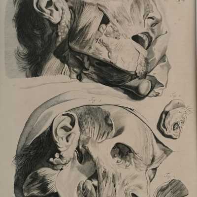 Bidloo surgical anatomy