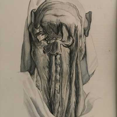 Bidloo surgical anatomy